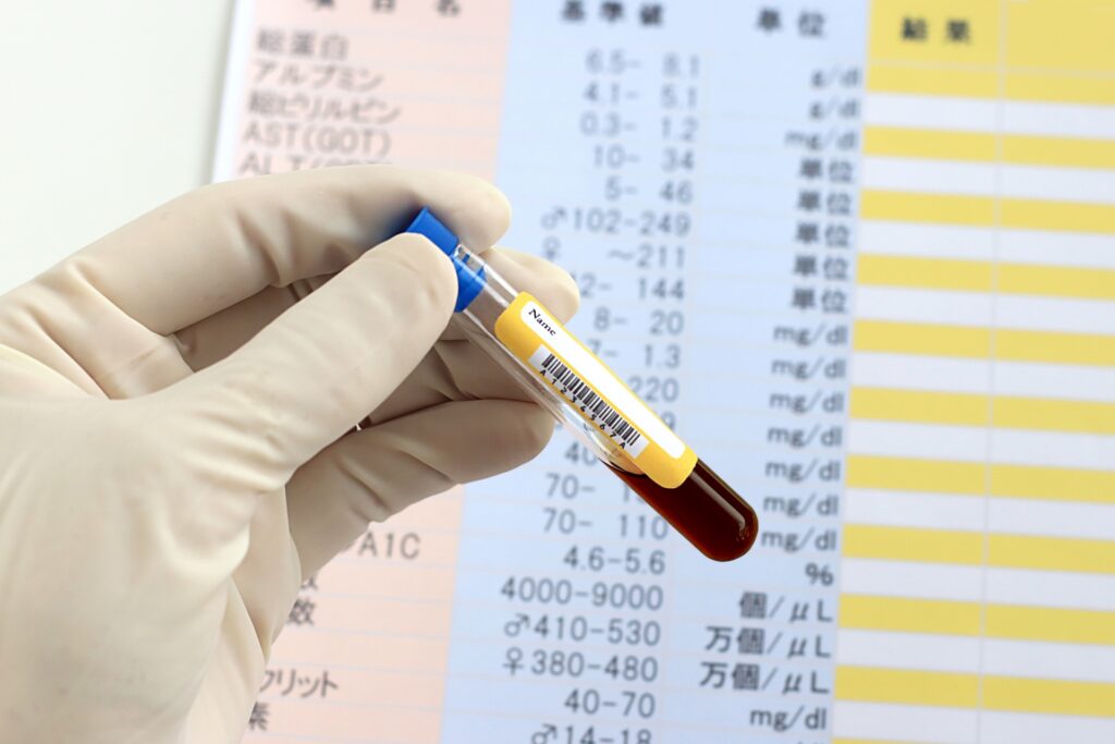 ALT・ASTの結果